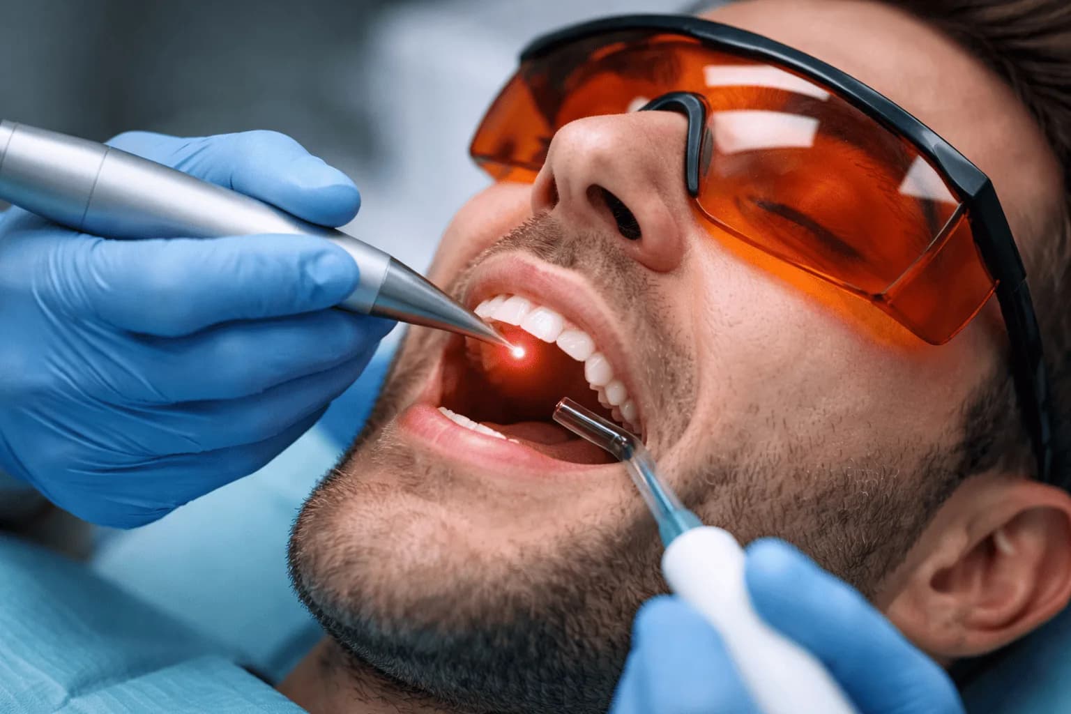 Tratamiento periodontal con láser dental en Mesena Dental