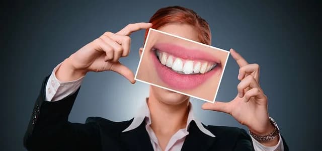 Blanqueamiento dental Mapfre