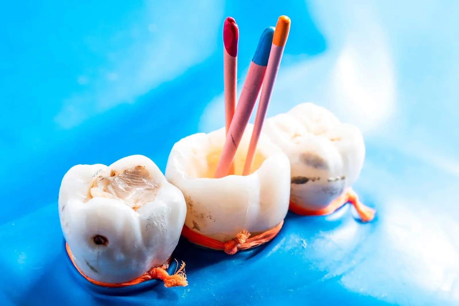 Tratamiento de endodoncia con aislamiento