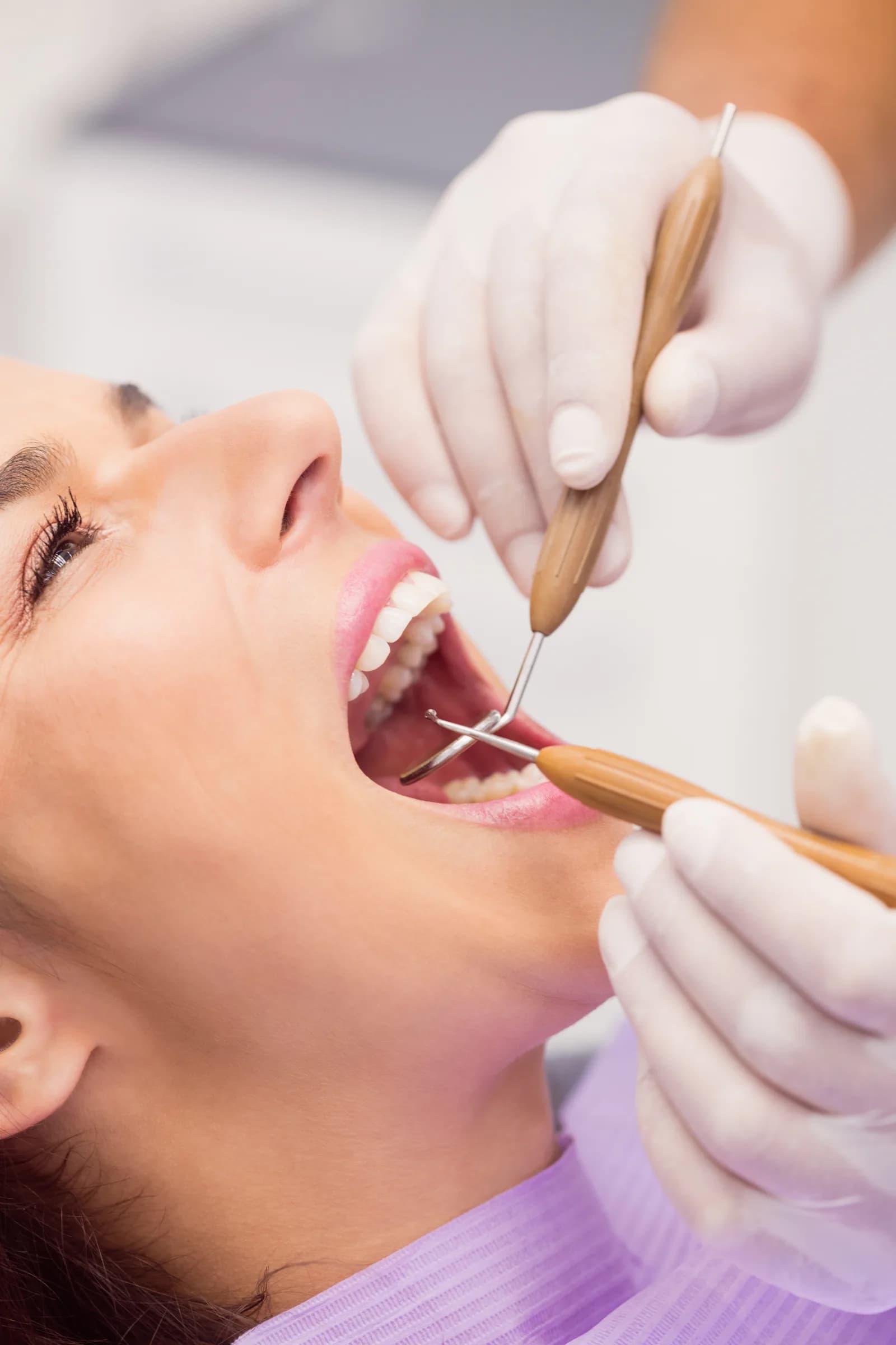 Limpieza dental profesional en Mesena Dental