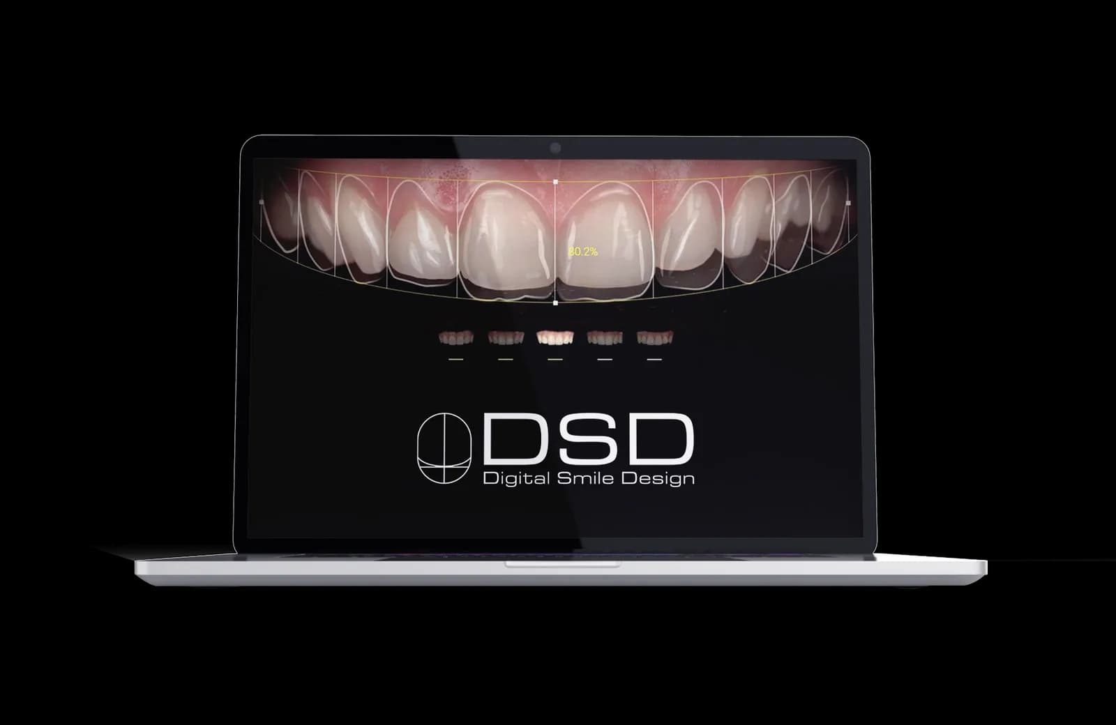 Simulación de diseño de sonrisa digital en pantalla