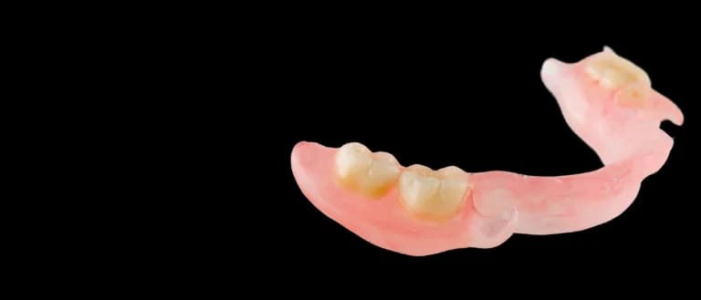Prótesis dental removible