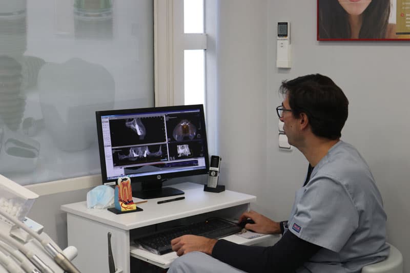 Doctor revisando un TAC dental en pantalla