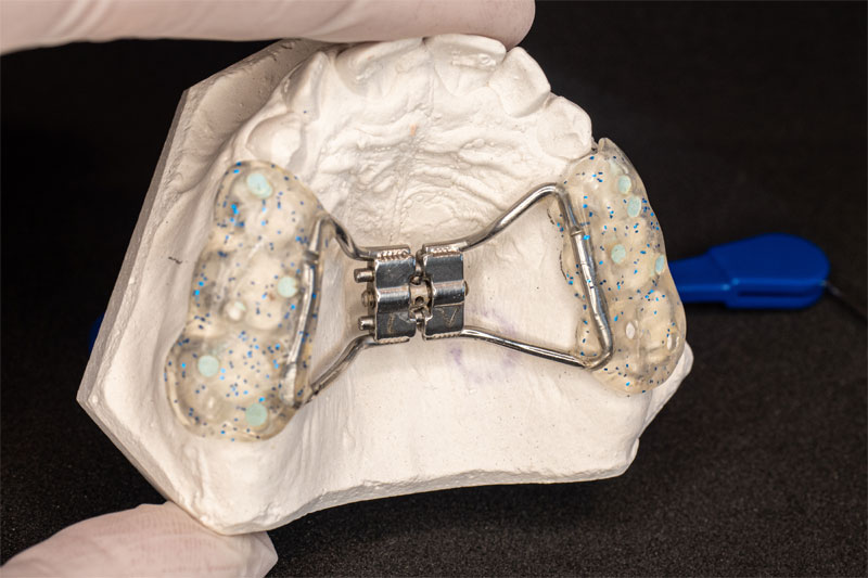 ortodoncia-funcional