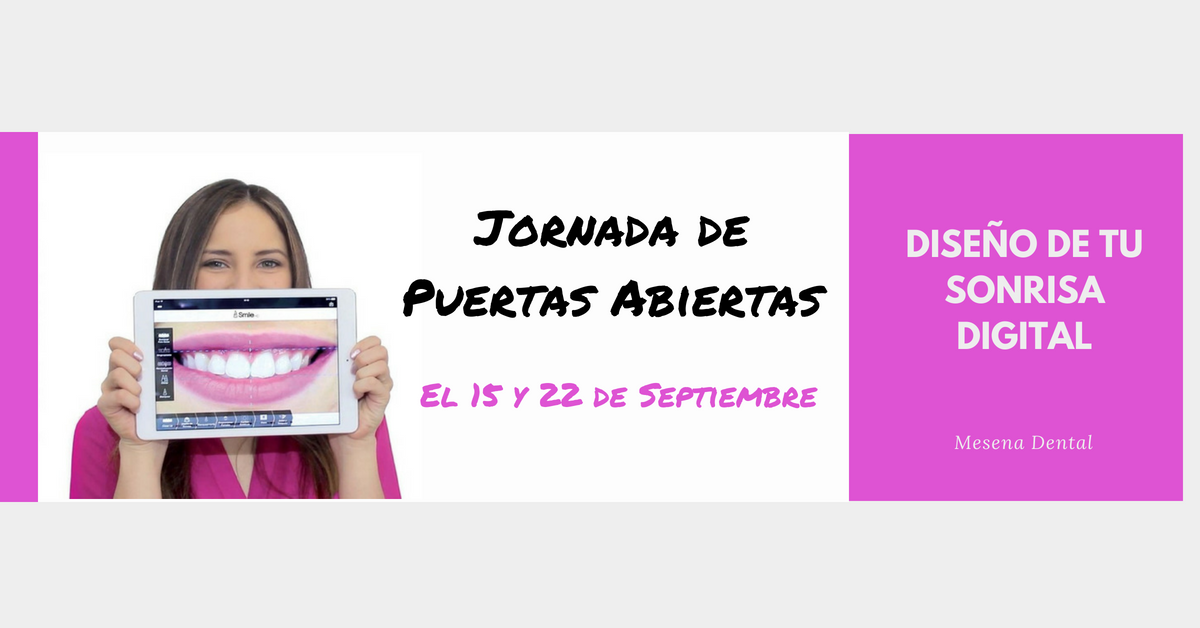ORNADA-DE-PUERTAS-ABIERTAS-DISENO-DE-SONRISA-DIGITAL-fb