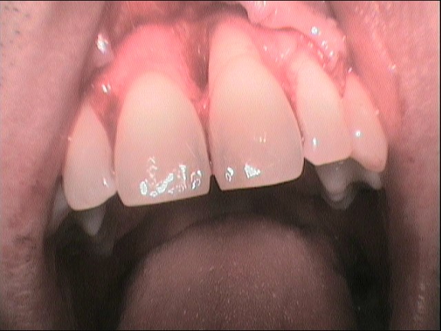 FOTO-1a