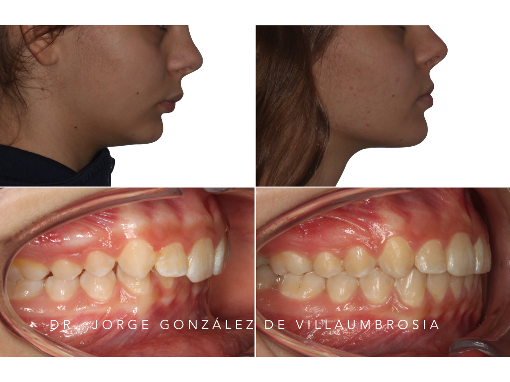 Odontología Joven | Mesena Dental